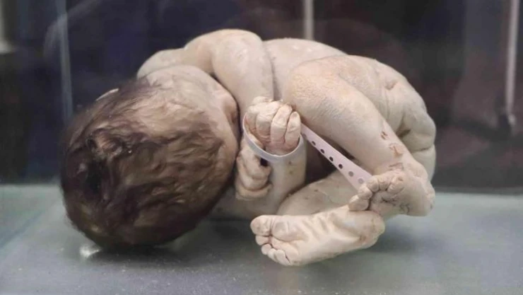 Asırlık cerrahi aletler bu müzede