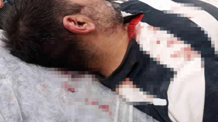 Büyükada'da kaçak inşaatı görüntülemek isteyen gazeteciye kazma kürek ile saldırdılar