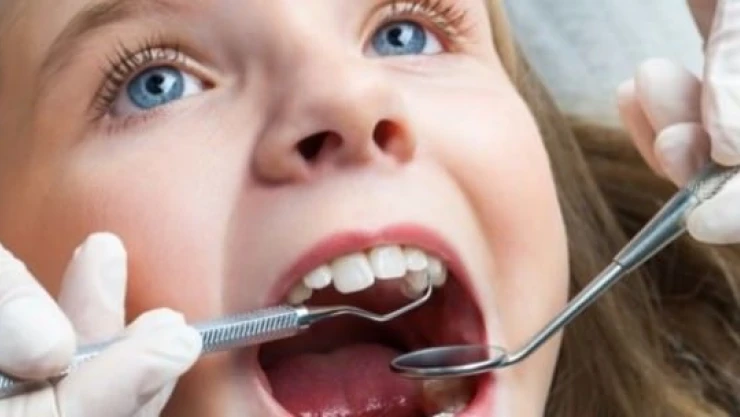 Sağlıklı dişler için bunları mutlaka yapın!