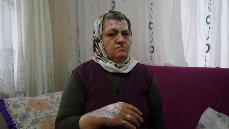 Yangında annesini kaybetti, canını zor kurtardı